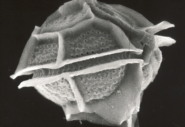Closeup of Pyrodinium Bahamense Bioluminescent Plankton
